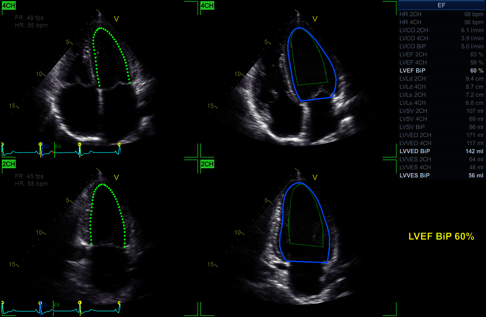 Klinický snímek zachycený pomocí nástroje EASY AutoEF