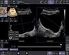 Auto Bladder Volume