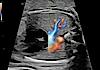 Ultrasound image captured using Radiantflow