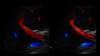 Liver vasculature ultrasound image
