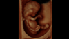 Ultrazvukový snímek 12týdenního plodu zachycený pomocí funkce HDlive