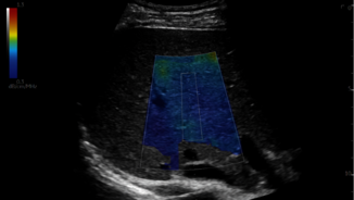 UGAP ultrasound image