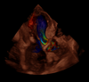 Ultrasound image captured using HD Color