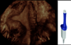 Ultrazvukový snímek zachycený pomocí sondy RIC5-9-RS