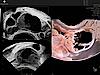 Ovary 3D ultrasound image