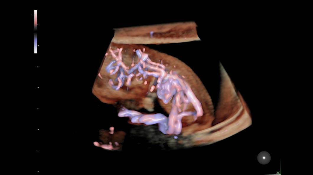 Ultrazvukový snímek oběhového systému 9týdenního plodu