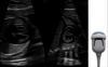 Image échographique capturée avec la sonde matricielle eM6C