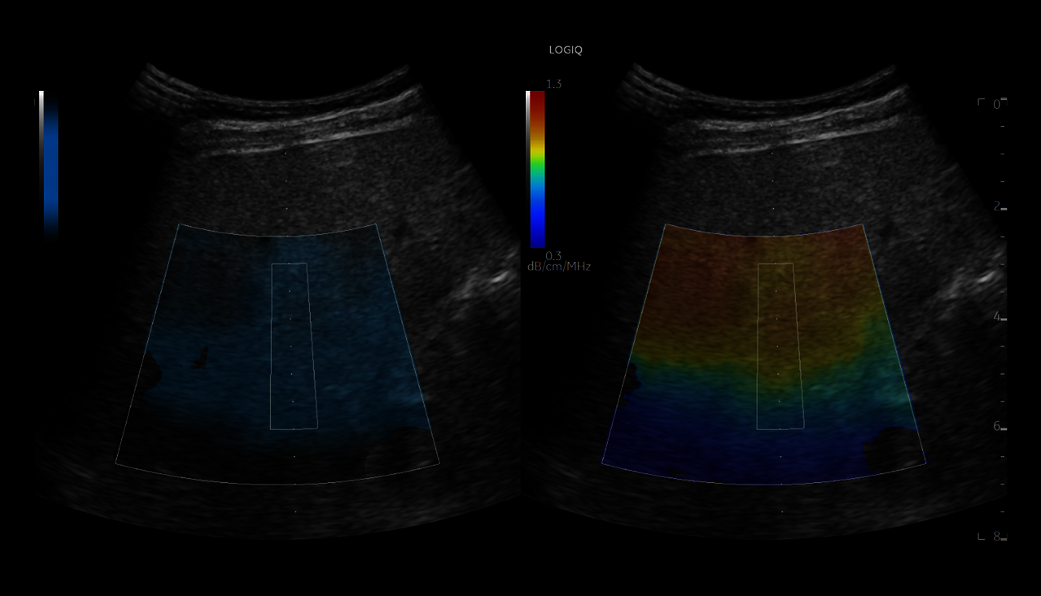 UGAP in pediatric liver, C2-9-D