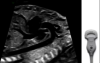 Ultrazvukový snímek zachycený pomocí sondy XDclear.
