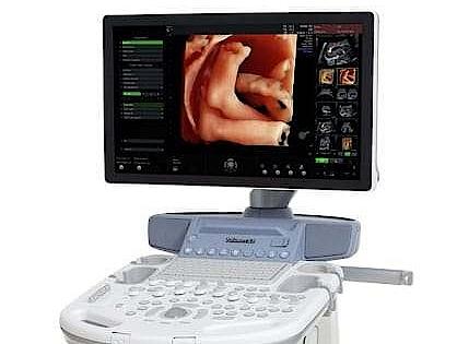 Voluson S8 ultrasound system