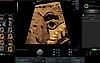 Ultrasound image captured using Scan Assistant