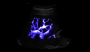 Liver Ultrasound Image