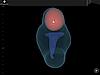 Fibroid Mapping Fibroid Mapping