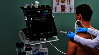 Ein Arzt führt eine MSK Ultraschalluntersuchung an der Schulter eines Patienten durch