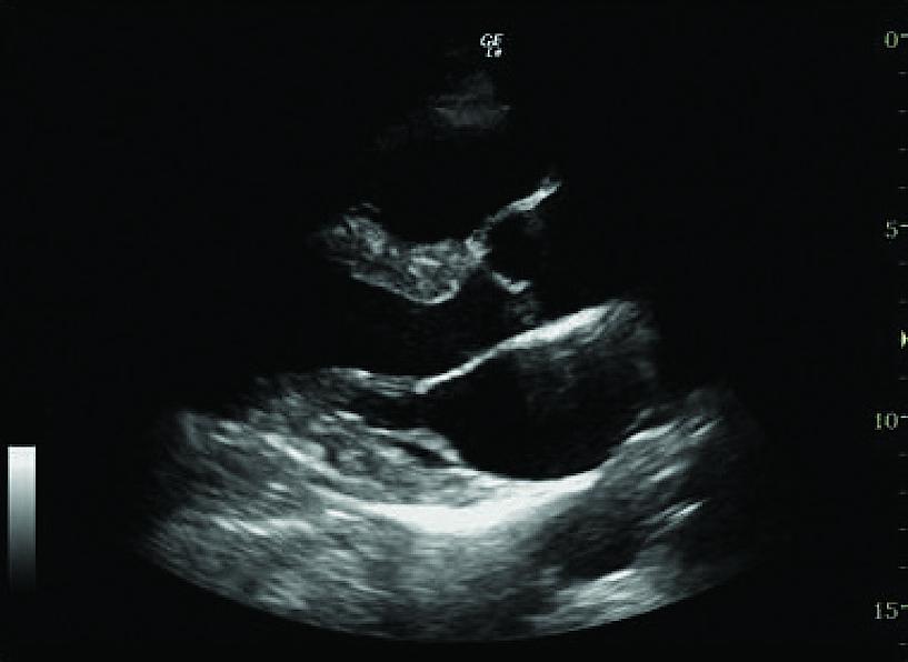 Ultrazvukový snímek vyšetření srdce