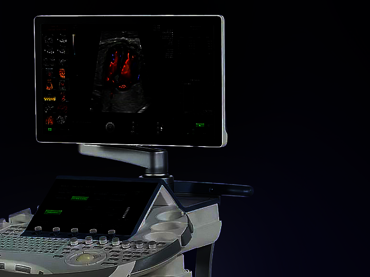 Voluson™ E8 RSA Ultrasound System
