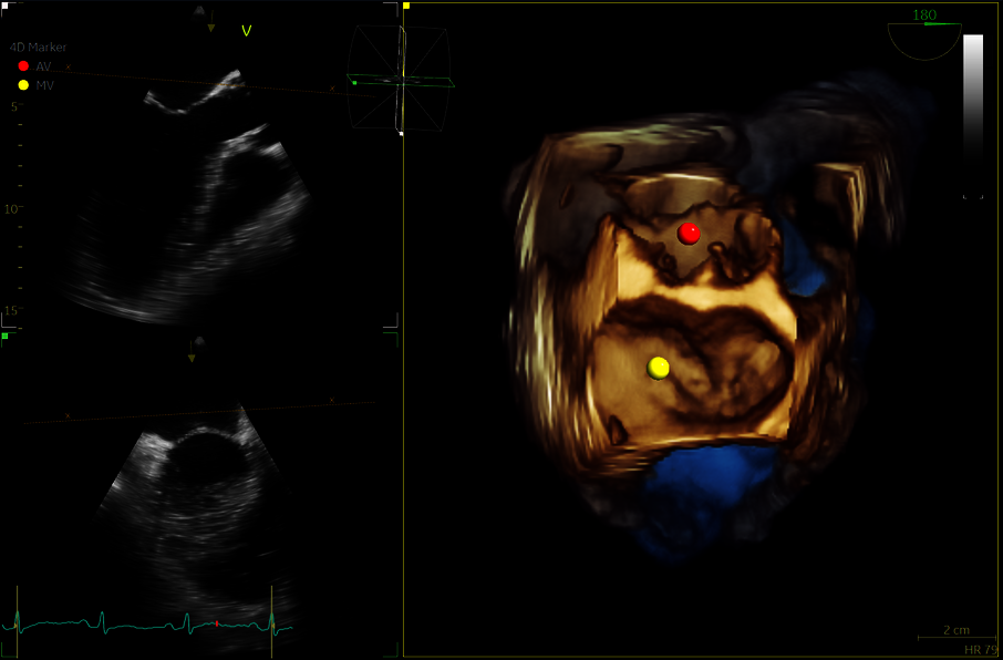 Klinický snímek zachycený pomocí funkce 4D Markers