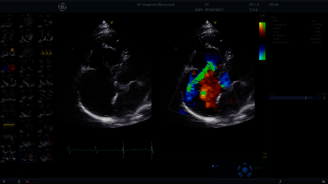 Klinický snímek zachycený během pediatrického ultrazvukového vyšetření