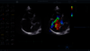 Clinical image captured during a pediatir ultrasound exam