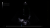 Ultrasound image captured using Real-Time EF