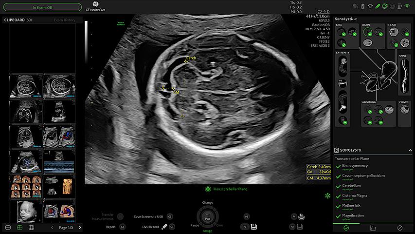 Voluson Signature 20 Clinical Image