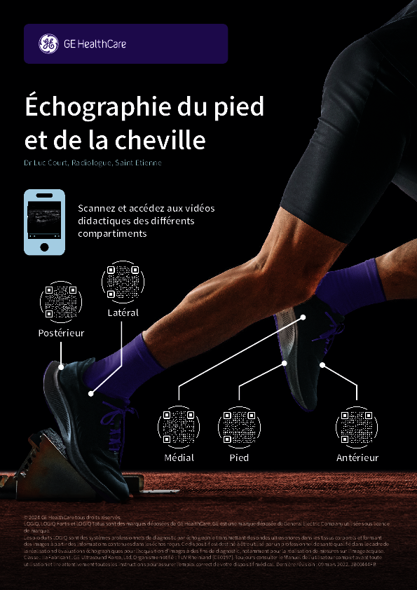 Echographie du pied et de la cheville