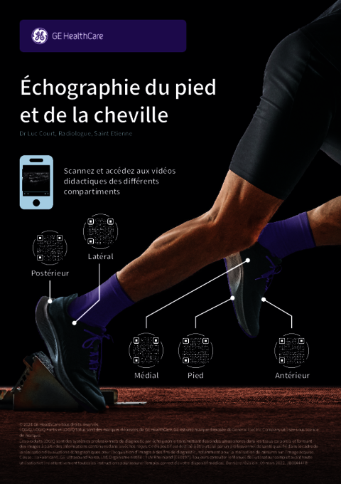 Poster échographie du pied et de la cheville