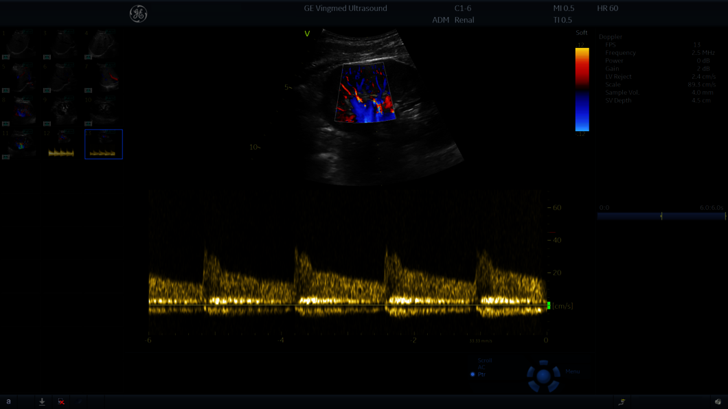 Clinical image captured during an abdominal ultrasound exam
