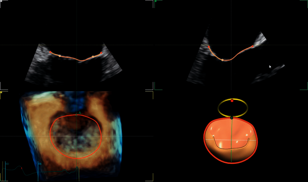 Klinický snímek zachycený pomocí aplikace 4D AUTO MVQ