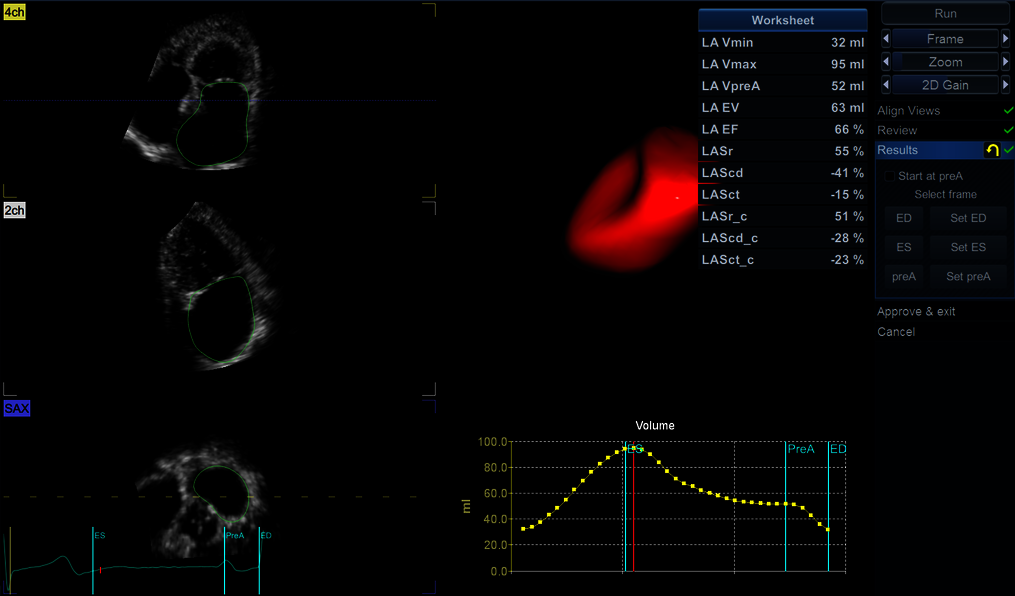Klinický snímek zachycený pomocí aplikace 4D AUTO LAQ