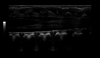 High resolution imaging of neonatal spine, ML4-16-D