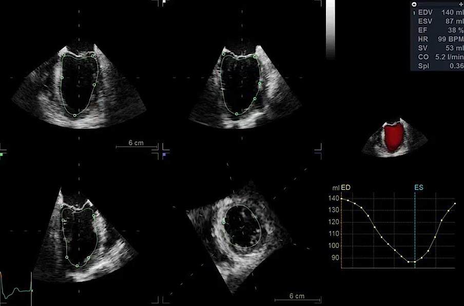 Clinical image captured by using 4D AUTO LVQ