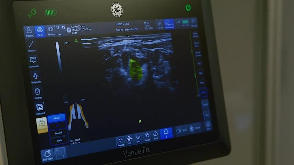 Video sur des cas pratiques de l'IA dans un hôpital en France