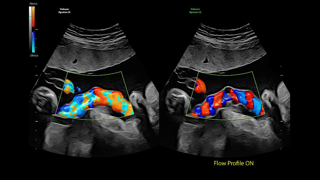 clinical image with Flow Profiles