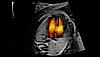 26-week fetal heart