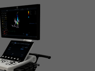 Vivid S70 ultrasound system