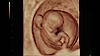 Image échographique d'une fœtus à neuf semaines