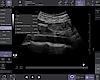 Gastric Measurement
