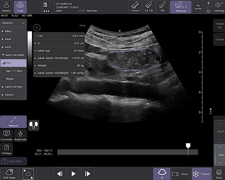 Gastric Measurement