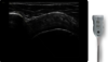 Shoulder procedure with L4-20t venue