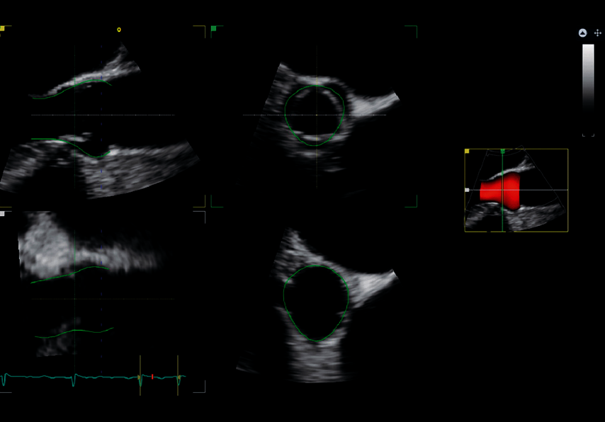 Klinický snímek zachycený pomocí aplikace 4D AUTO AVQ