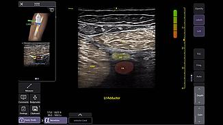 Nerveblox image clinique assité par l'IA