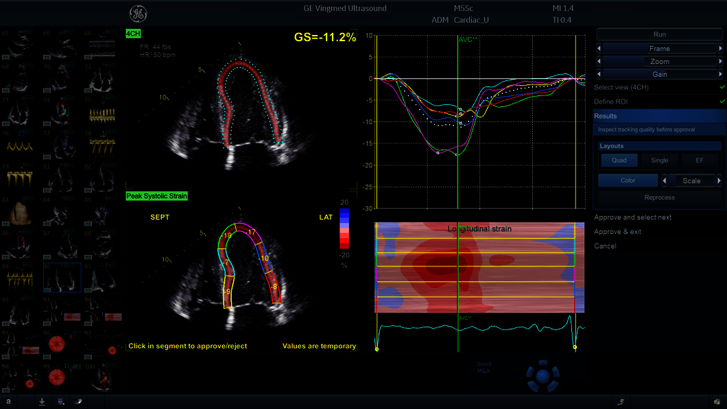 Clinical image captured using AFI RV