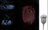 Υπερηχογραφική εικόνα που λαμβάνεται με κεφαλή μήτρας όγκου RM7C