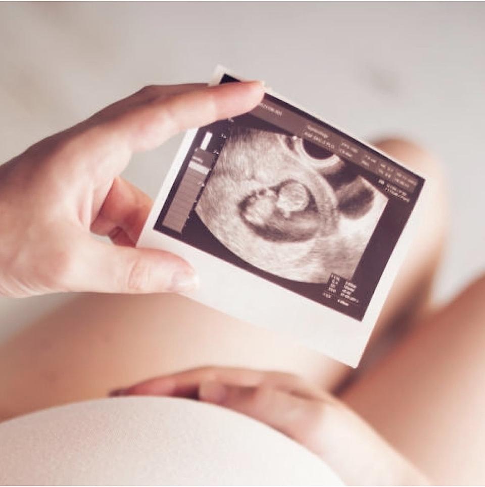 Nahaufnahme: Eine Schwangere hält ein Ultraschallbild Ihres Fötus in der Hand