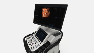 Ultraschallgerät der Vivid E Serie