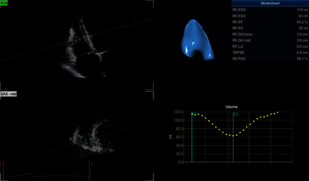 Klinický snímek zachycený pomocí funkce 4D Auto RVQ