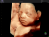 AI powered ExPress3D rendering of a realistic fetal face at 27 weeks gestation.