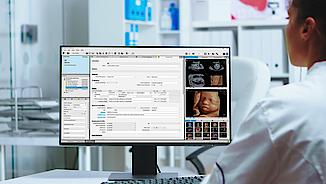 A doctor is doing his ultrasound reporting with ViewPoint 6 software