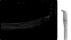 Achilles LOGIQe with L8-18i probe